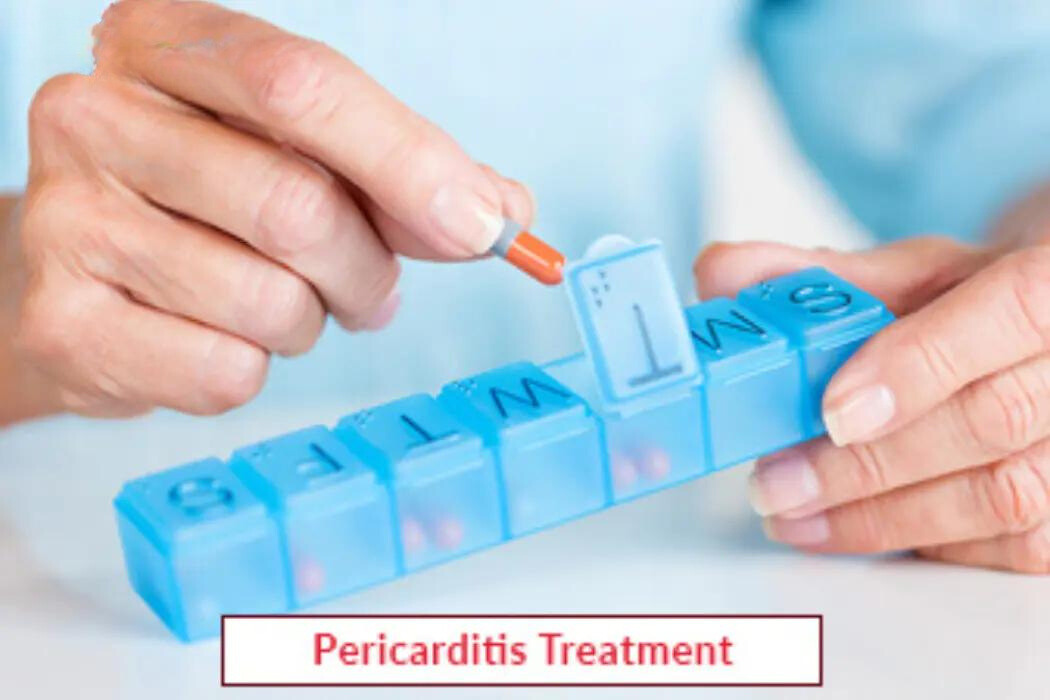 Pericarditis Treatment