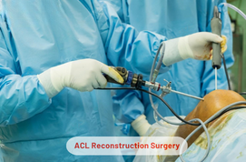 ACL Reconstruction Surgery