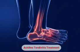 Achilles Tendinitis Treatment