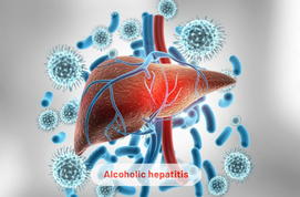 Alcoholic Hepatitis