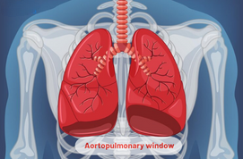 Aortopulmonary window