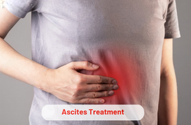 Ascites Treatment