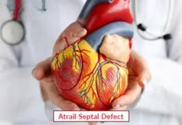 Atrail Septal Defect