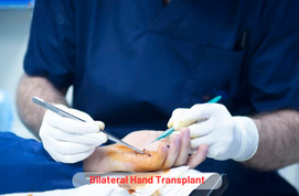 Bilateral Hand Transplant