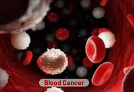 Blood Cancer