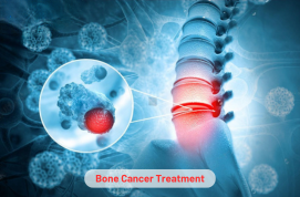 Bone Cancer Treatment