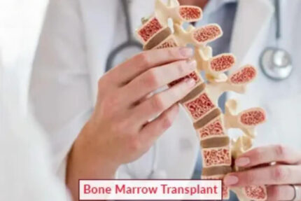 Bone Marrow Transplant