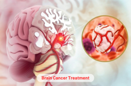 Brain Cancer Treatment