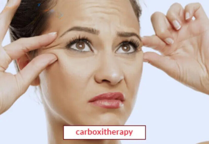 Carboxitherapy