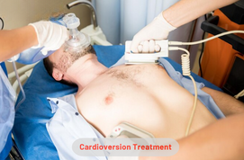 Cardioversion Treatment