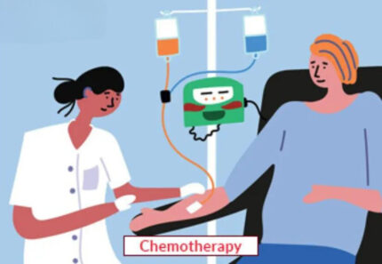 Chemotherapy