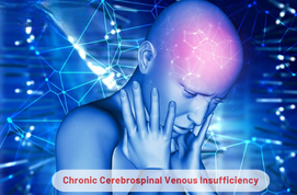 Chronic Cerebrospinal Venous Insufficiency