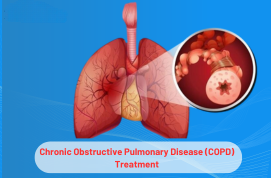 Chronic Obstructive Pulmonary Disease Treatment