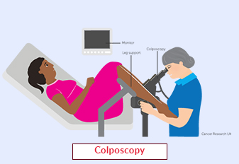 Colposcopy