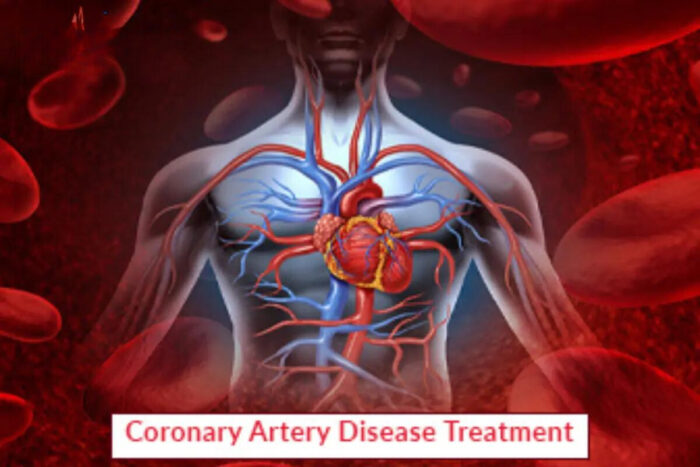 Coronary Artery Disease