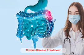 Crohn’s Disease Treatment