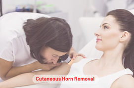 Cutaneous Horn Removal