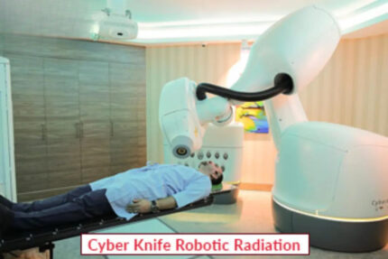 Cyber Knife Robotic Radiation