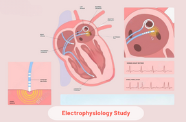 Electrophysiology Study