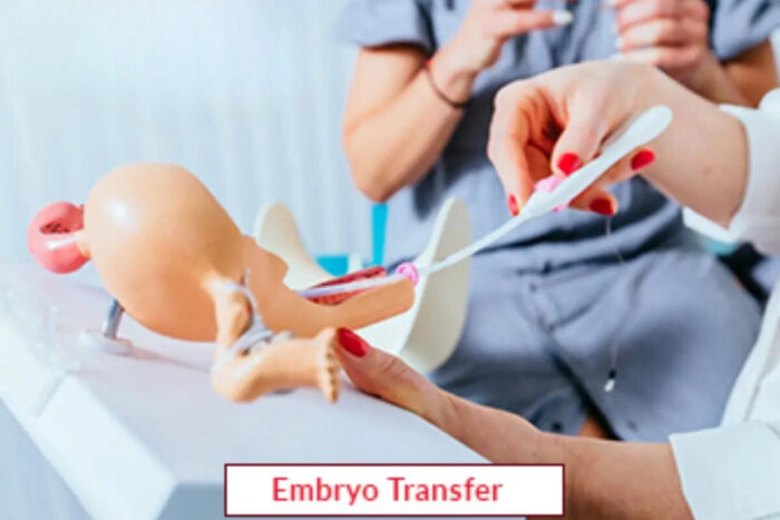 Embryo Transfer