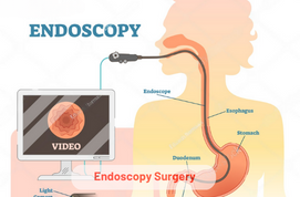 Endoscopy Surgery