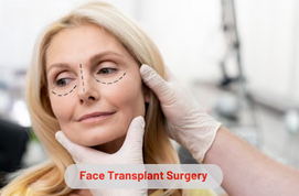 Face Transplant Surgery