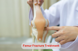 Femur Fracture Treatment