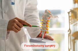 Foraminotomy surgery