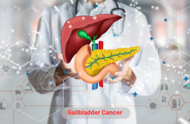 Gallbladder Cancer