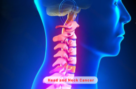 Head and Neck Cancer Treatment