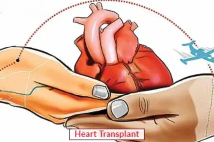 Heart Transplant