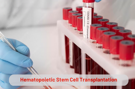 Hematopoietic Stem Cell Transplantation