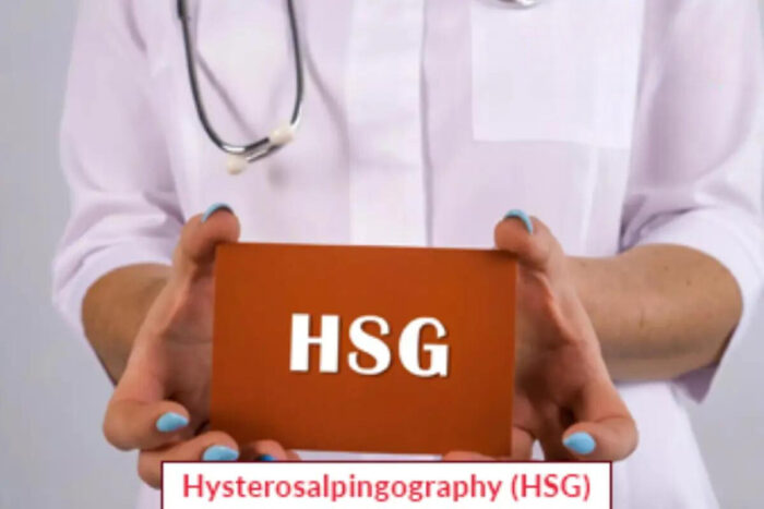 Hysterosalpingography (HSG)