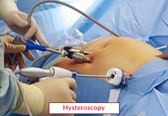 Hysteroscopy