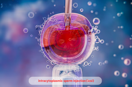 Intracytoplasmic Sperm Injection (ICSI)