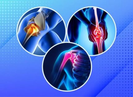 Joint Replacement Surgery