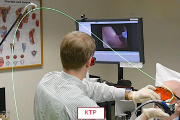 KTP Treatment