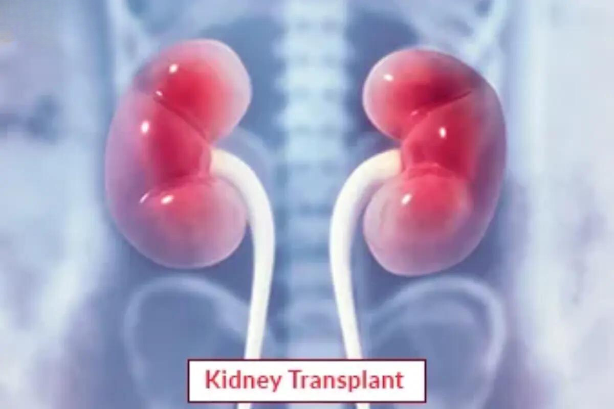 Kidney Transplant