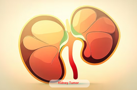 Kidney Tumor