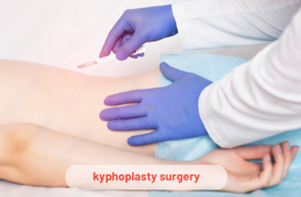 Kyphoplasty Surgery