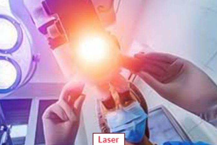 Laser Eye Surgery