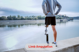 Limb Amputation