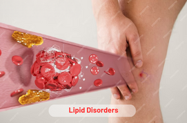 Lipid Disorders