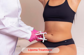 Lipoma Treatment