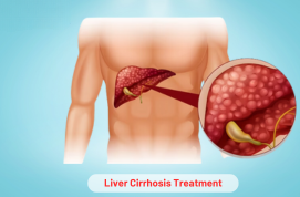 Liver Cirrhosis Treatment