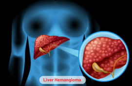 Liver Hemangioma