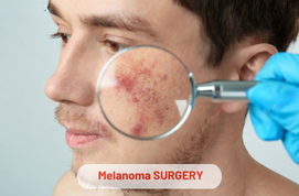 Melanoma Surgery