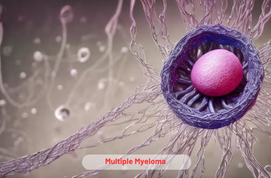 Multiple Myeloma Treatment