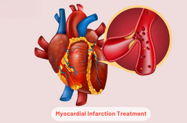 Myocardial Infarction Treatment