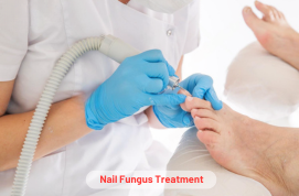 Nail Fungus Treatment